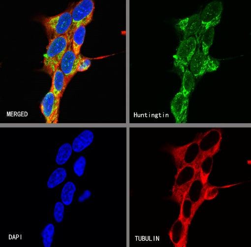 Huntingtin Recombinant Rabbit mAb (S-1481-147)
