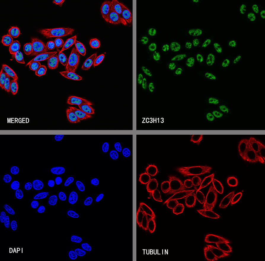 ZC3H13 Recombinant Rabbit mAb (S-5530)