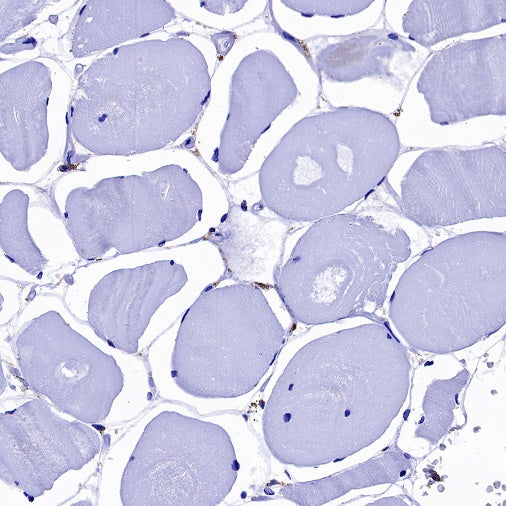 B7-H3 Recombinant Rabbit mAb (SDT-1333-8)