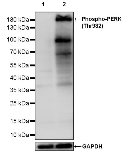 Phospho-PERK (Thr982) Recombinant Rabbit mAb (S-1801-106)