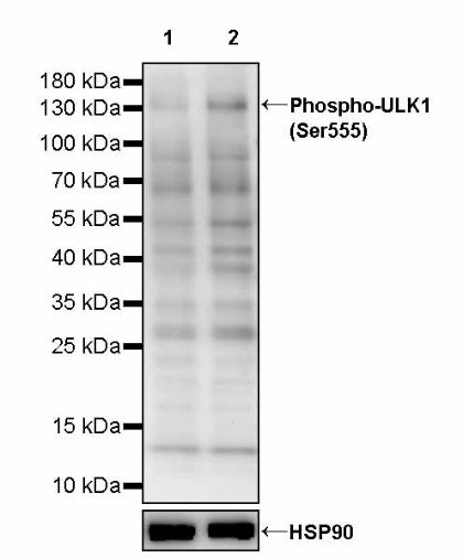 Phospho-ULK1 (Ser555) Recombinant Rabbit mAb (S-3440)