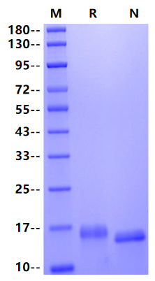 MARCO(405-520) His Tag Protein, Human