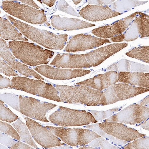 MTCO2 Rabbit Polyclonal Antibody