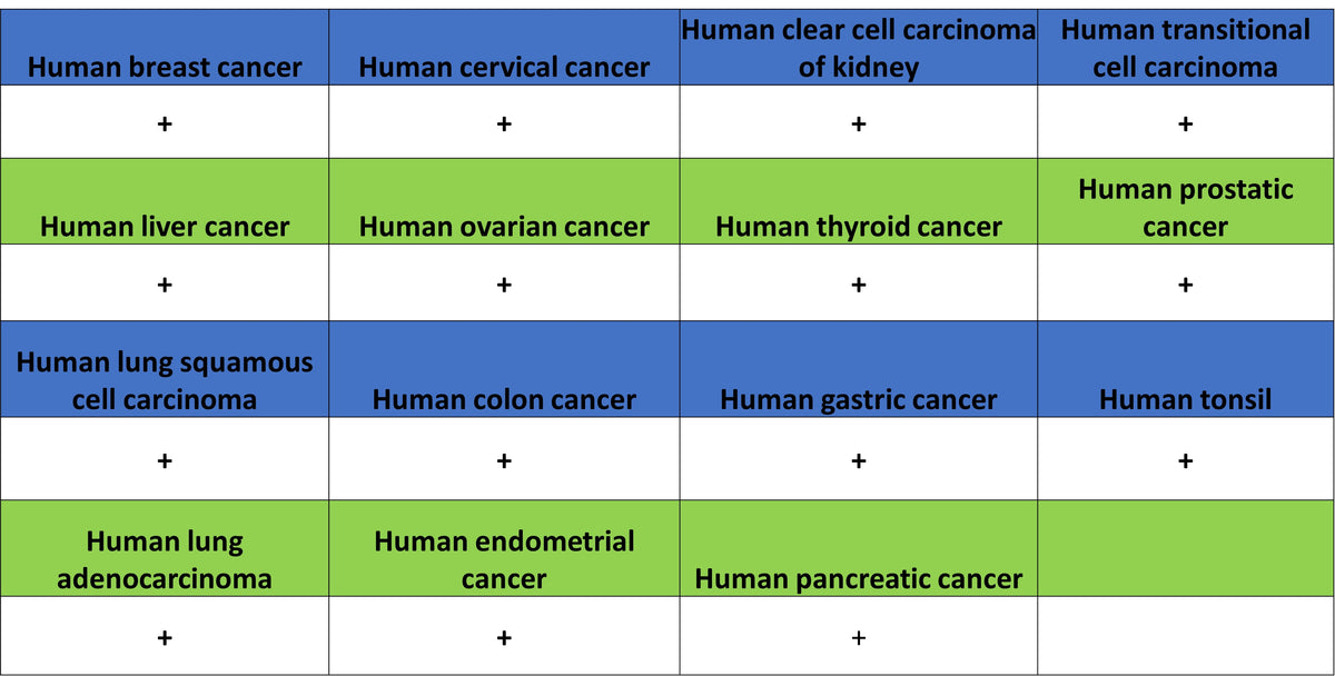 COL3A1 Recombinant Rabbit mAb (S-4338)