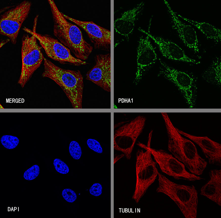 PDHA1 Recombinant Rabbit mAb