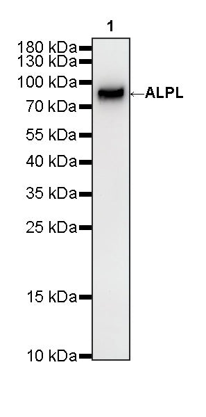 ALPL Recombinant Rabbit mAb