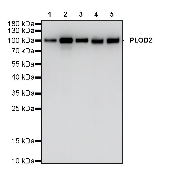 PLOD2 Mouse mAb