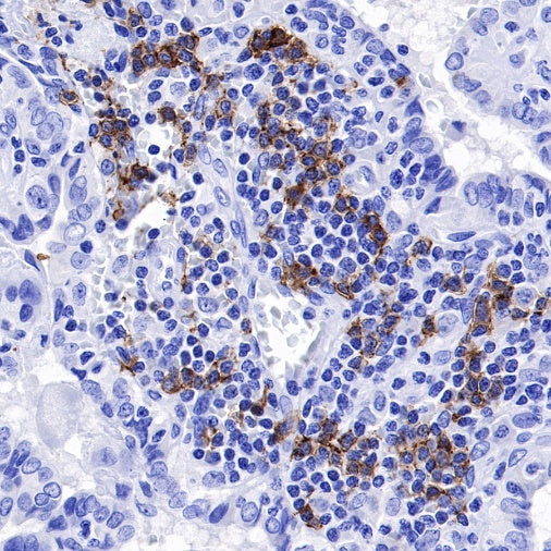 CD20 Recombinant Rabbit mAb (SDT-038-205)