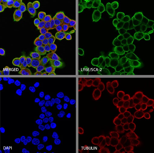 LY6E/SCA-2 Recombinant Rabbit mAb (S-2681-56)