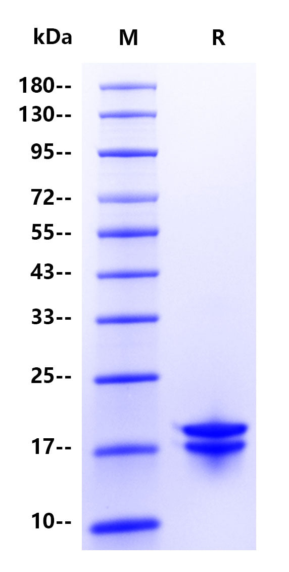 IL-2 Protein His Tag Protein , Human