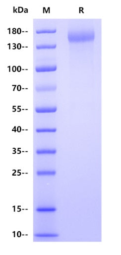 Felis CD21 Protein, His tag