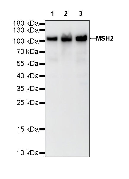 MSH2 Recombinant Rabbit mAb (SDT-037-20)