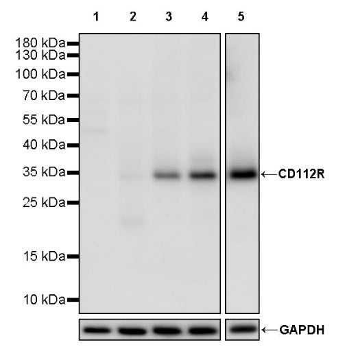 CD112R Recombinant Rabbit mAb (S-1923-22)