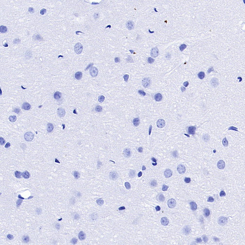 S-RMab® FSHB Recombinant Rabbit mAb (SDT-544-22)