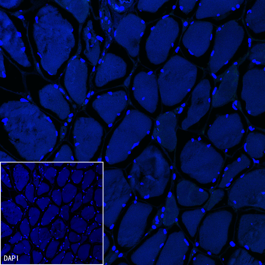 CD79a/MB-1 Recombinant Rabbit mAb (SDT-030-18)