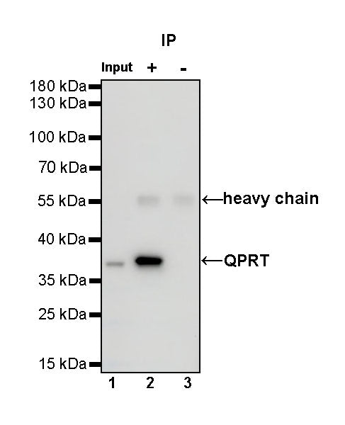QPRT Recombinant Rabbit mAb (S-1228-31)