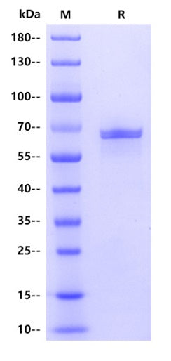 Human Tau-441/2N4R Protein, His tag