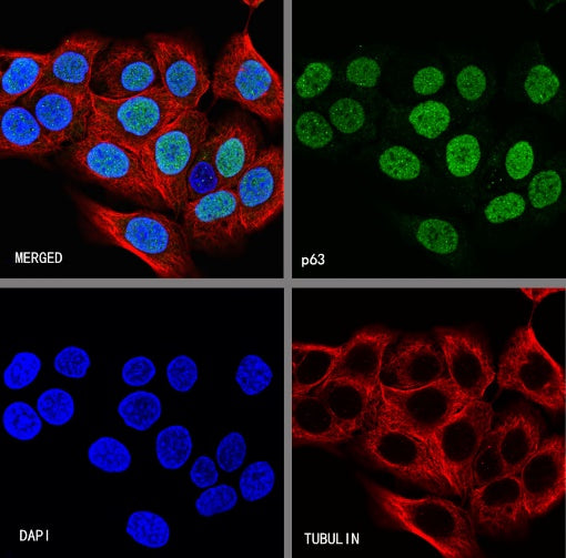 p63 Recombinant Rabbit mAb (SDT-054-137)