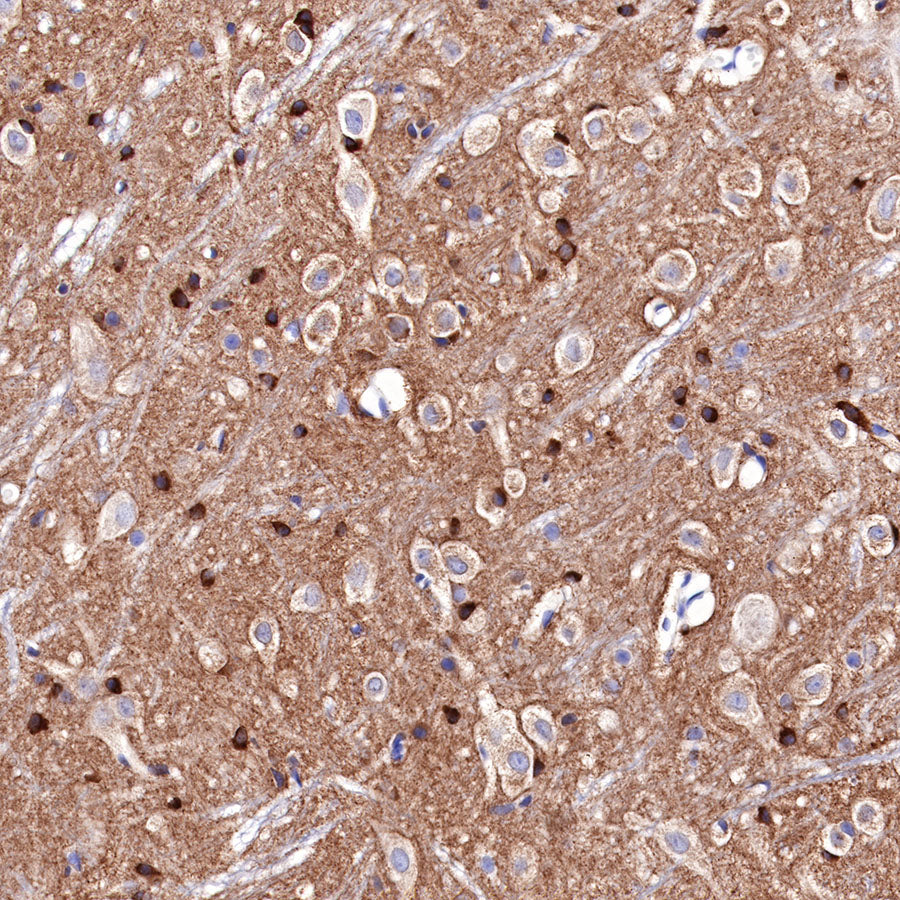 Tau Recombinant Mouse mAb (SDT-R145)
