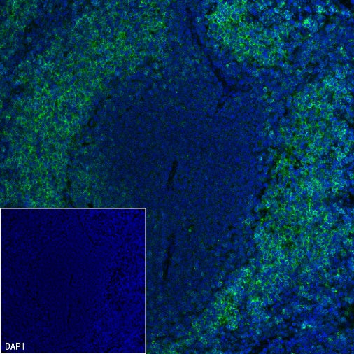 CD20 Recombinant Rabbit mAb (Alexa Fluor® 488 Conjugate) (S-R133)
