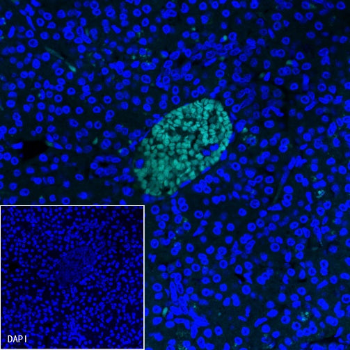 Glucagon Recombinant Rabbit mAb (S-365-17)