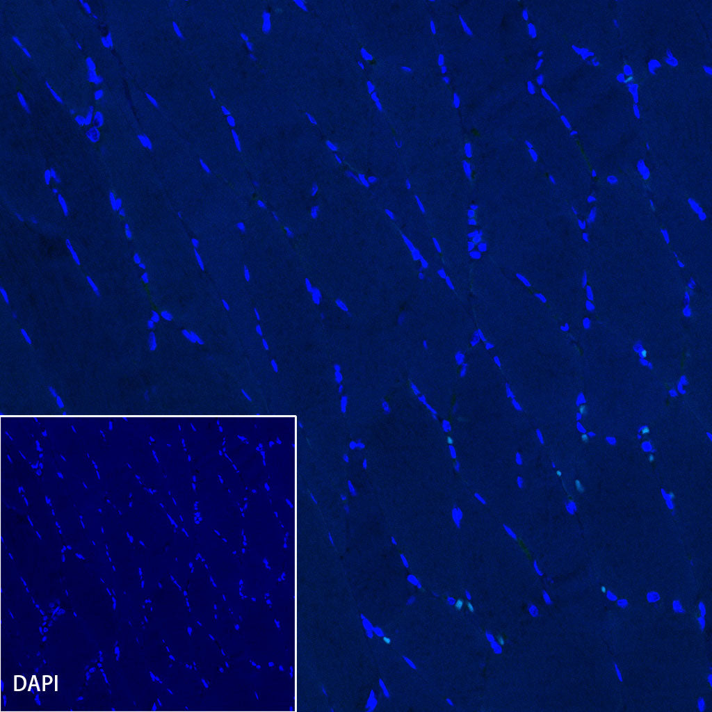 Cadherin 17 Recombinant Rabbit mAb (SDT-R151)