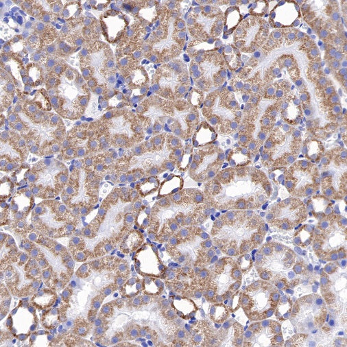 Bad Recombinant Rabbit mAb (S-976-26)