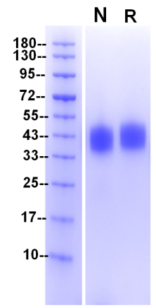 Fc γ RIIIa/CD16a(F176) His Tag Protein, Human