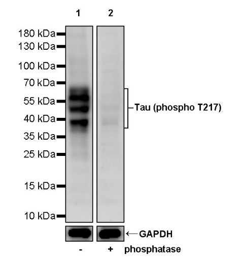 Tau (phospho T217) Recombinant Rabbit mAb (S-176-213)