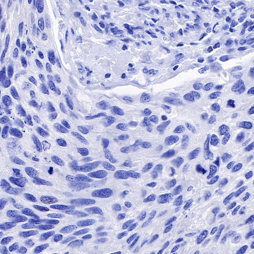 TPO Recombinant Rabbit mAb (SDT-420-57)