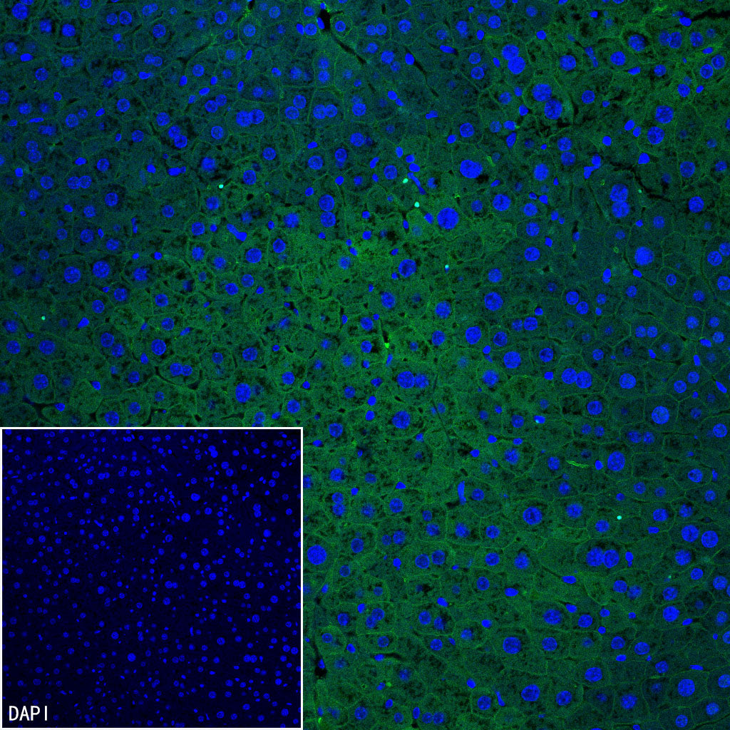 SLC43A2 Recombinant Rabbit mAb (S-4492-33)