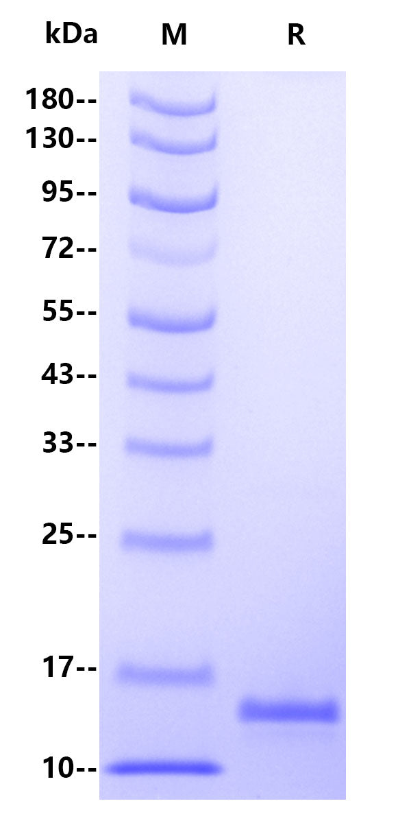 Human PCT(Procalcitonin), His Tag