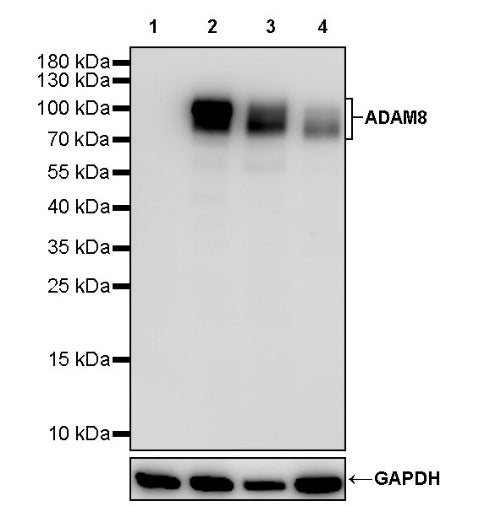 ADAM8 Recombinant Rabbit mAb (S-2546-23)