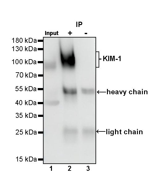 KIM-1 Recombinant Rabbit mAb (S-932-2)