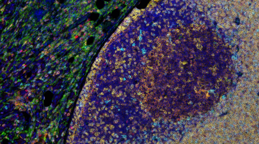 Absin 6-Color IHC Kit (Anti-Rabbit and Mouse Secondary Antibody)
