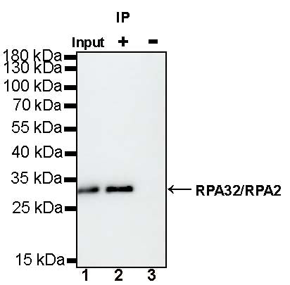 RPA32/RPA2 Rabbit Polyclonal Antibody