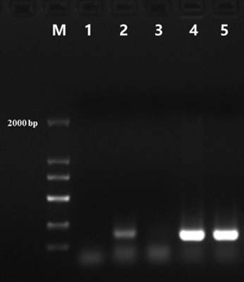 StartScript® 1st Strand cDNA Synthesis Kit, with DNase I