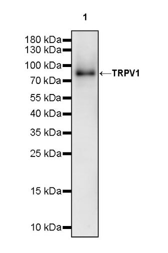 TRPV1 Recombinant Rabbit mAb (S-2021-75)