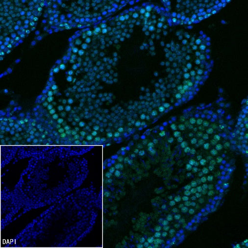 Ki67 Recombinant Rabbit mAb (Alexa Fluor® 488 Conjugate) (SDT-R459)