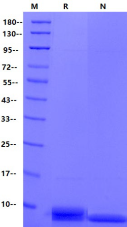 Saposin-A His Tag Protein, Human