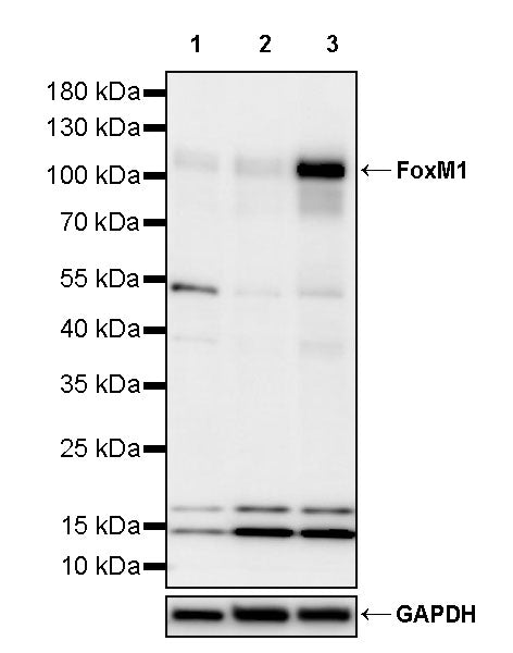 FoxM1 Recombinant Rabbit mAb (S-3223-138)