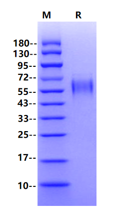 Ebola virus Glycoprotein/GP RBD His Tag Protein, Ebola virus-AHX24649