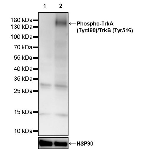 Phospho-TrkA (Tyr490)/TrkB (Tyr516) Recombinant Rabbit mAb (S-3812)