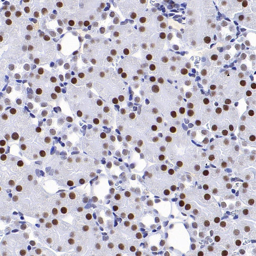 CDK9 Rabbit Polyclonal Antibody