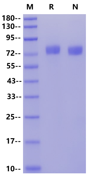 H1N1 HA (A/Puerto Rico/8/1934) His Tag Protein