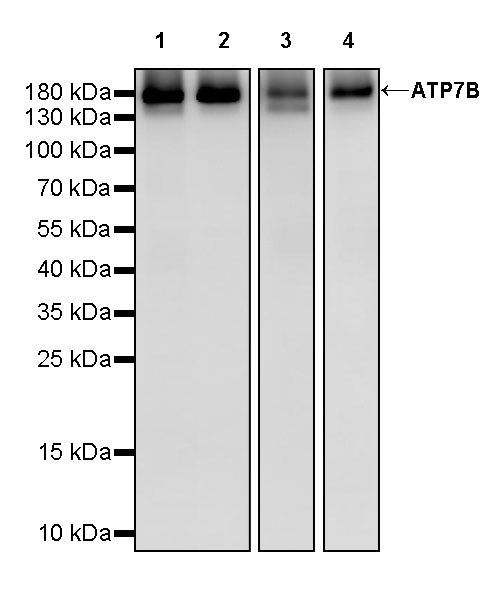 ATP7B Recombinant Rabbit mAb (S-2827-58)