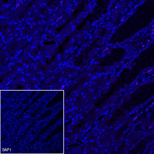 Helicobacter pylori Recombinant Rabbit mAb (Cy5 Conjugate) (S-R273)