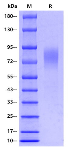 Human SCARB1/SR-BI Protein, His tag