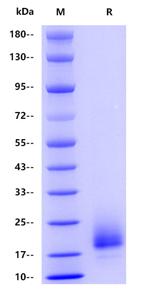 Human FGFR3/CD333, His tag
