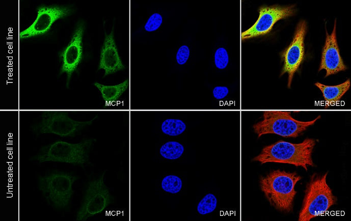MCP1 Recombinant Rabbit mAb (S-1737-3)